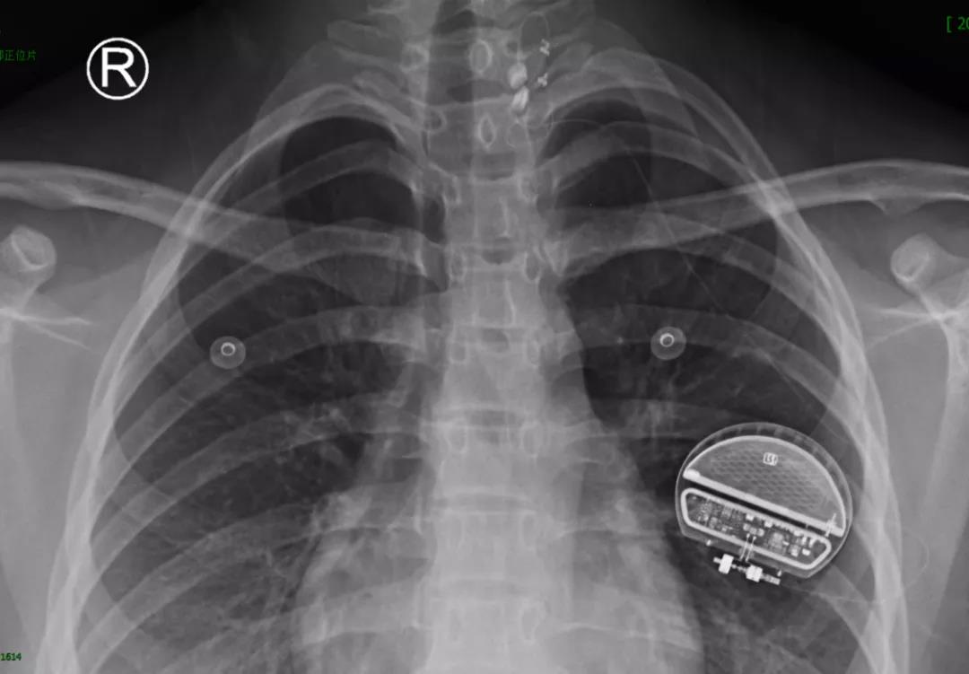 微信图片_20200811090257.jpg 微信图片_20200811090257.jpg