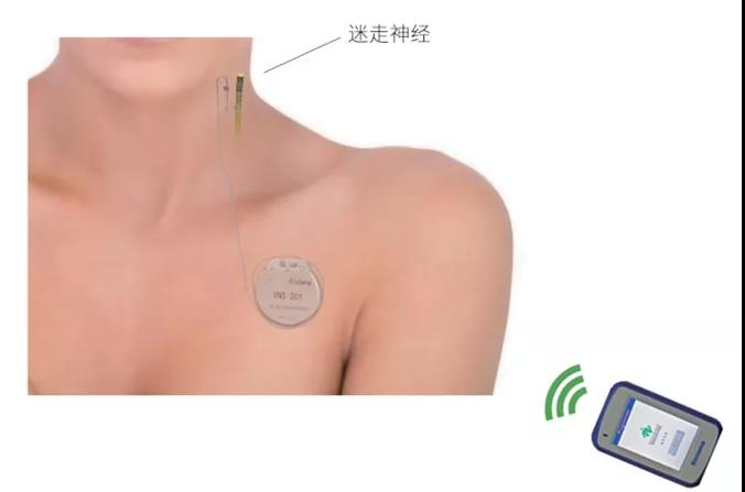 微信图片_20200811090305.jpg 微信图片_20200811090305.jpg