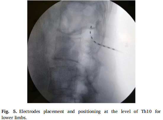 图片5.png 图片5.png
